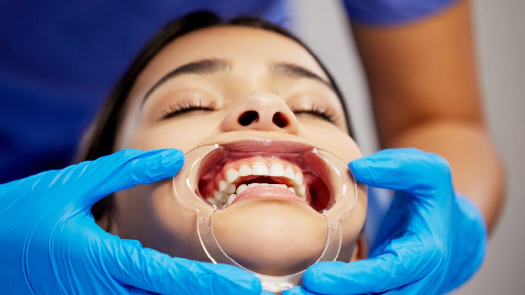 Bruxismo: el enemigo de tu sonrisa