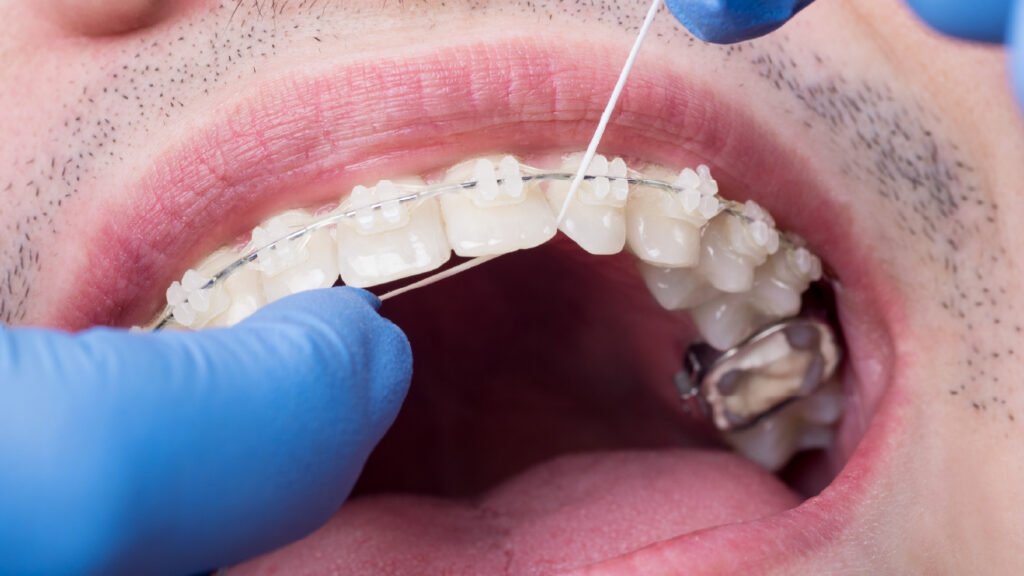 Ortodoncia en adultos: solución a problemas articulares, periodontales y oclusales